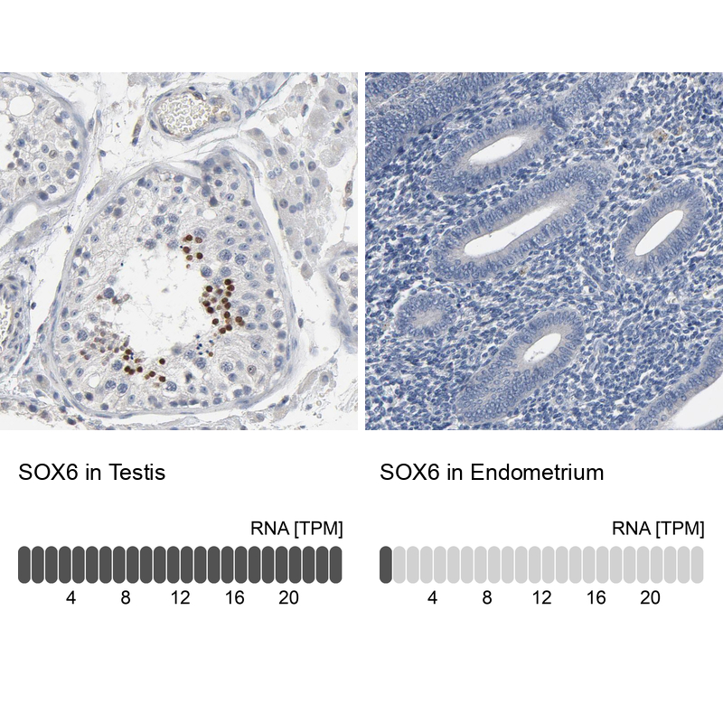 Atlas Antibodies Anti-SOX6 Antibody