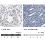 Atlas Antibodies Anti-SOX6 Antibody