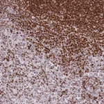 Atlas Antibodies Anti-SP110 Antibody