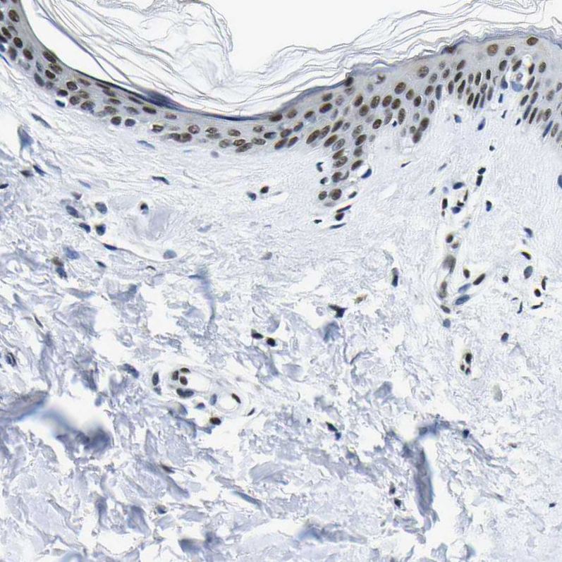 Atlas Antibodies Anti-SP1 Antibody