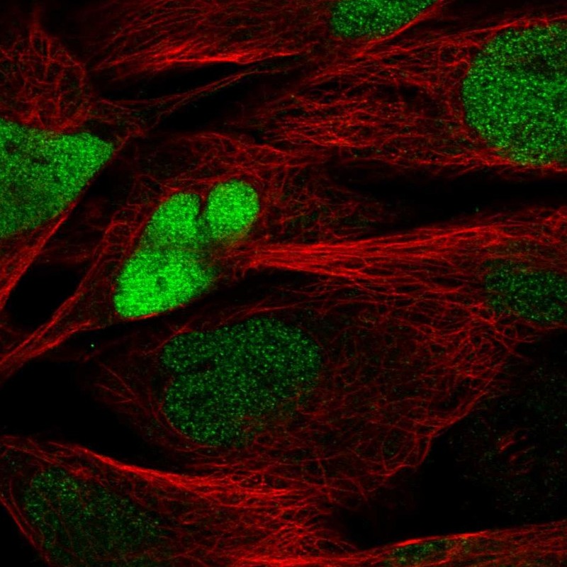 Atlas Antibodies Anti-SOX8 Antibody