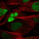 Atlas Antibodies Anti-SOX8 Antibody