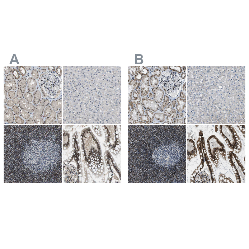 Atlas Antibodies Anti-SP100 Antibody