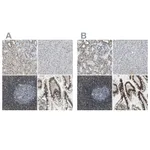 Atlas Antibodies Anti-SP100 Antibody
