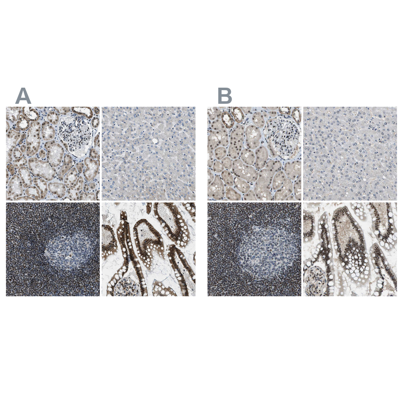 Atlas Antibodies Anti-SP100 Antibody