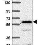 Atlas Antibodies Anti-SP110 Antibody
