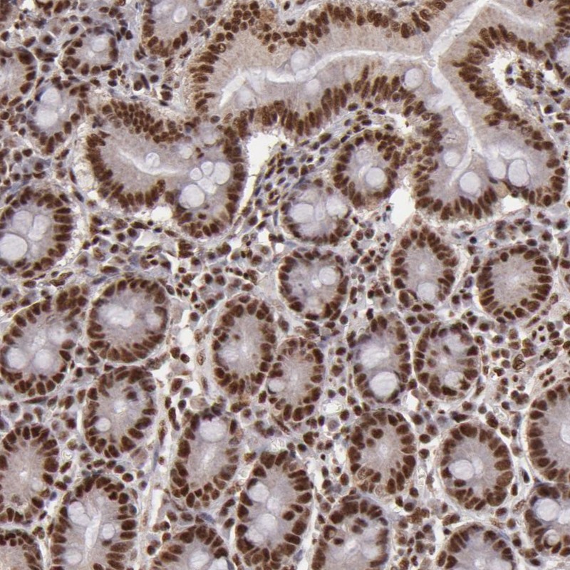 Atlas Antibodies Anti-SP1 Antibody