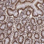 Atlas Antibodies Anti-SP1 Antibody