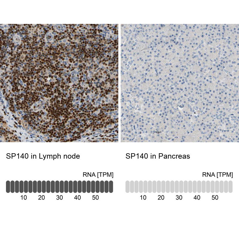 Atlas Antibodies Anti-SP140 Antibody