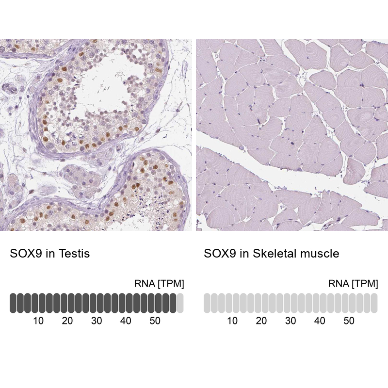 Atlas Antibodies Anti-SOX9 Antibody