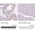 Atlas Antibodies Anti-SOX9 Antibody