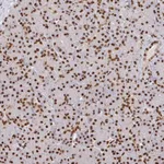 Atlas Antibodies Anti-SP3 Antibody