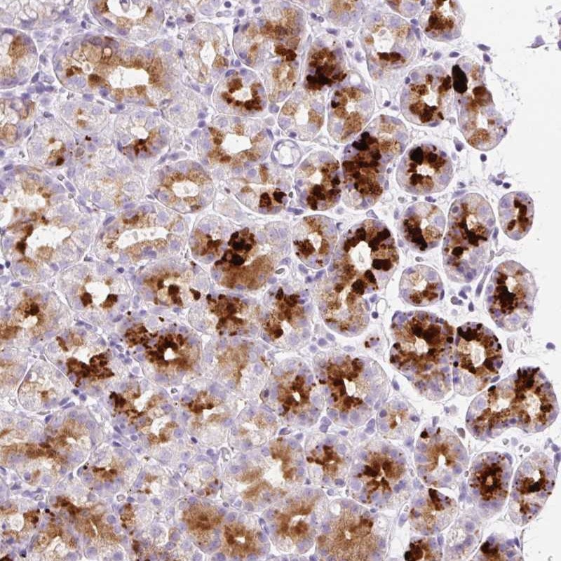 Atlas Antibodies Anti-SP140L Antibody