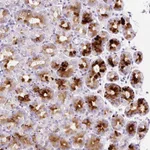 Atlas Antibodies Anti-SP140L Antibody