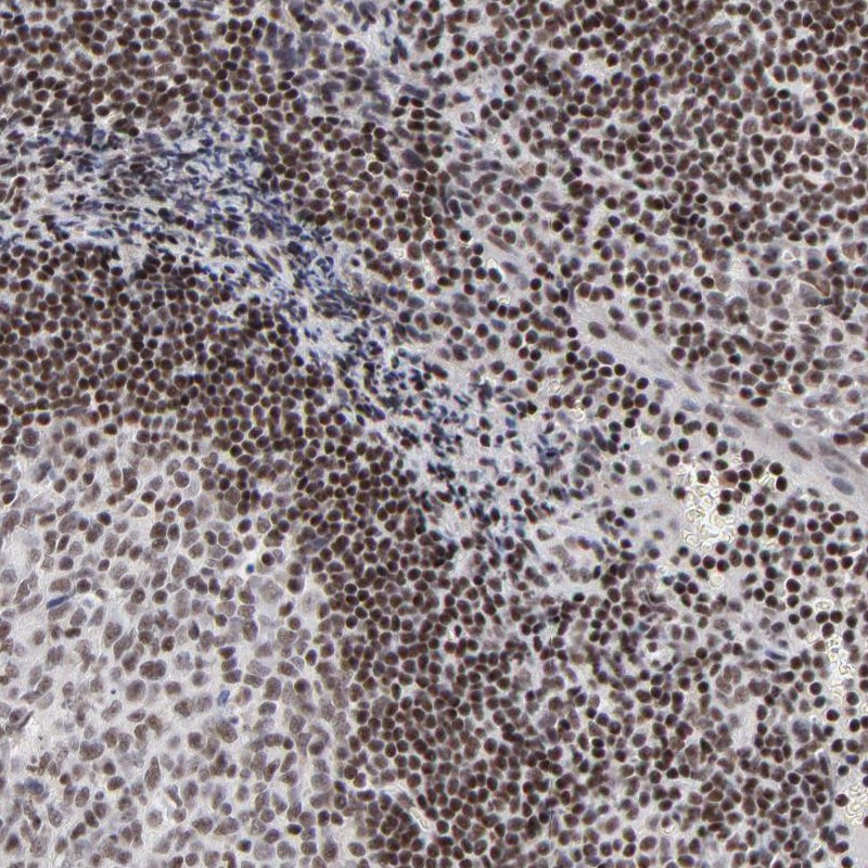 Atlas Antibodies Anti-SP2 Antibody