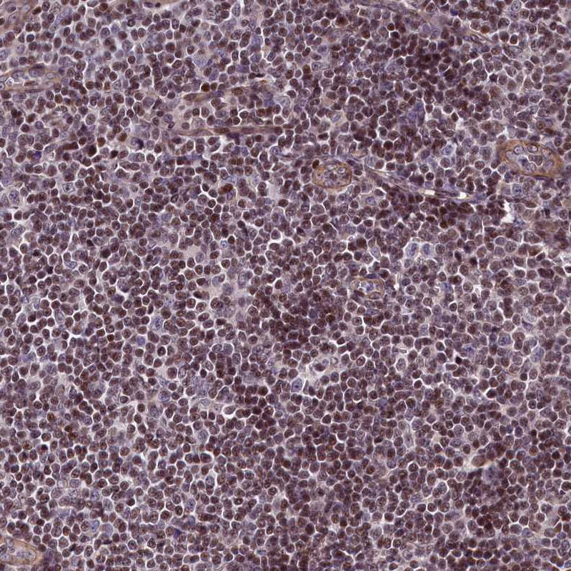 Atlas Antibodies Anti-SP4 Antibody