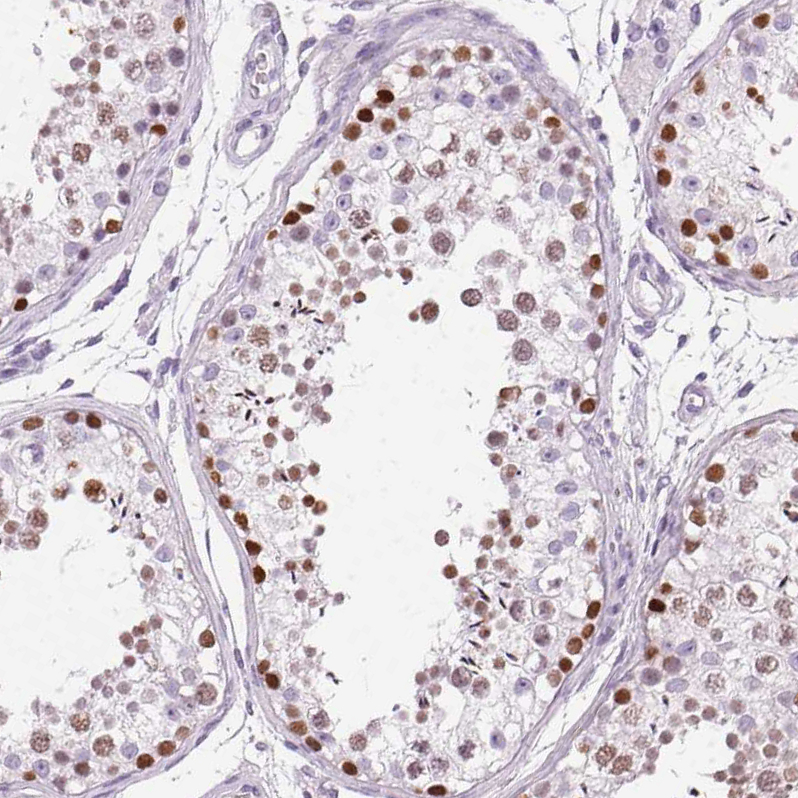 Atlas Antibodies Anti-SP7 Antibody