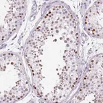 Atlas Antibodies Anti-SP7 Antibody