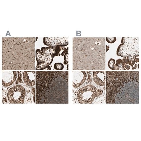Merck Anti-CANX antibody produced in rabbit