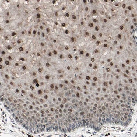 Merck Anti-NUAK2 antibody produced in rabbit