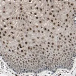 Merck Anti-NUAK2 antibody produced in rabbit