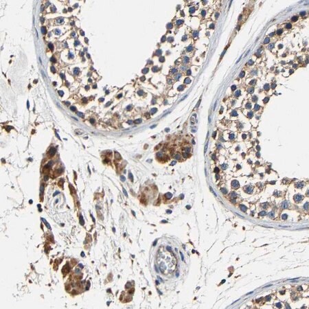 Merck Anti-MTX1 antibody produced in rabbit