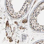 Merck Anti-MTX1 antibody produced in rabbit