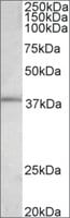 Merck ANTI-FOS