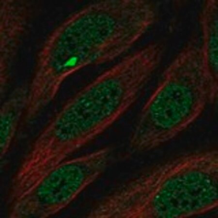 Merck Anti-MCPH1 antibody produced in rabbit