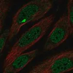 Merck Anti-MCPH1 antibody produced in rabbit