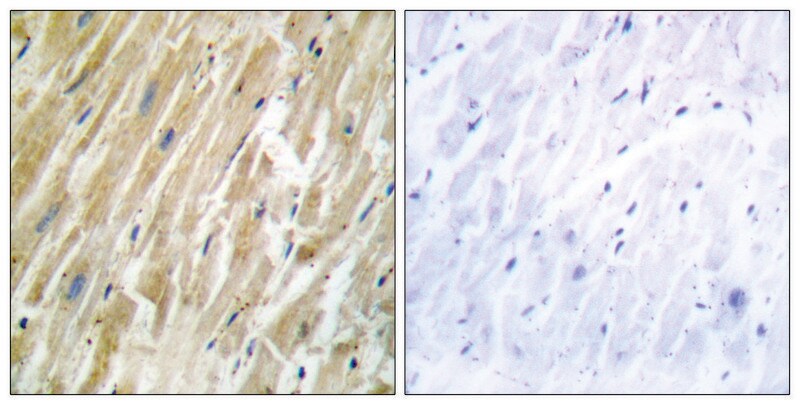 Merck Anti-CALR antibody produced in rabbit