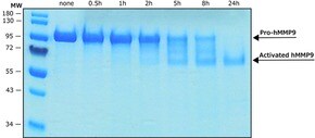 Merck MMP-9 HUMAN RECOMBINANT, >=1,300 PMOL/MI