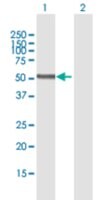 Merck ANTI-PNPLA3