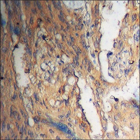 Merck Anti-phospho-Akt (pThr308) antibody produced in rabbit