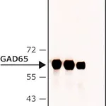 Merck Anti-GAD65 antibody , Mouse monoclonal &