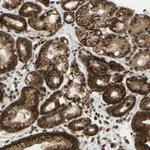 Merck Anti-GALNT1 antibody produced in rabbit