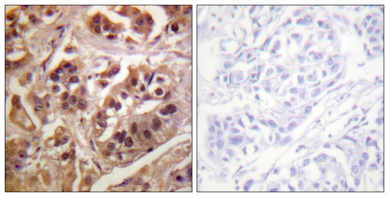 Merck Anti-IKK-gamma antibody produced in rabbit
