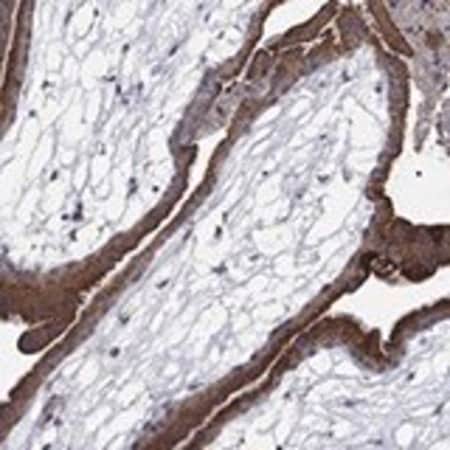 Merck Anti-MMAA antibody produced in rabbit