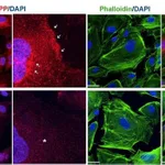 Thermo Fisher Scientific Goat anti-Rabbit IgG (H+L) Cross-Adsorbed Secondary Antibody, Alexa Fluor 488