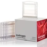 Thermo Fisher Scientific Novex Tris-Glycine Mini Protein Gels, 8%, 1.0 mm, WedgeWell format, 10 gels (1 box)