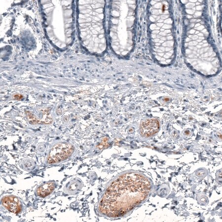 Merck Anti-CXCL8 antibody produced in rabbit