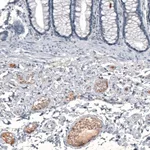 Merck Anti-CXCL8 antibody produced in rabbit