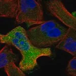 Merck Anti-ANXA6 antibody produced in rabbit