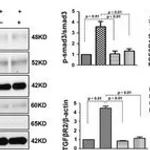 Merck ANTI-TGF BETA RECEPTOR I