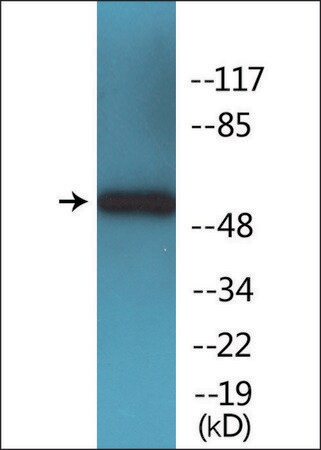Merck Anti-phospho-SOX-9 (pSer181) antibody produced in rabbit
