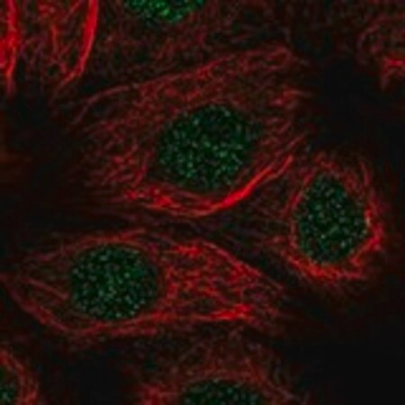 Merck Anti-ALKBH1 antibody produced in rabbit