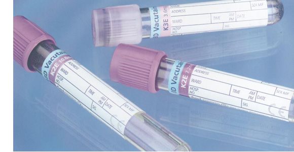 Glass Aprotinine K3EDTA tube 5ml with Pink Hemogard Closure
