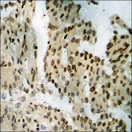 Merck Anti-phospho-Tyrosine Hydroxylase (pSer19) antibody produced in rabbit