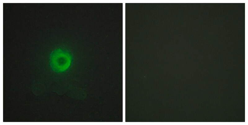 Merck Anti-TNF Receptor II, antibody produced in rabbit