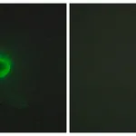 Merck Anti-TNF Receptor II, antibody produced in rabbit